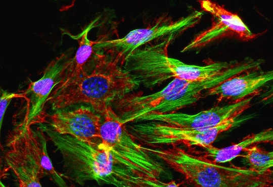 How Rejuvenation Of Stem Cells Could Lead To Healthier Aging